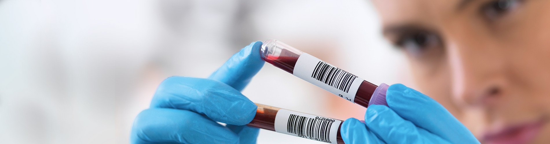 Oncohematology